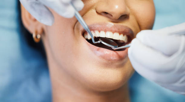 Dentist for Dental Trauma in UT